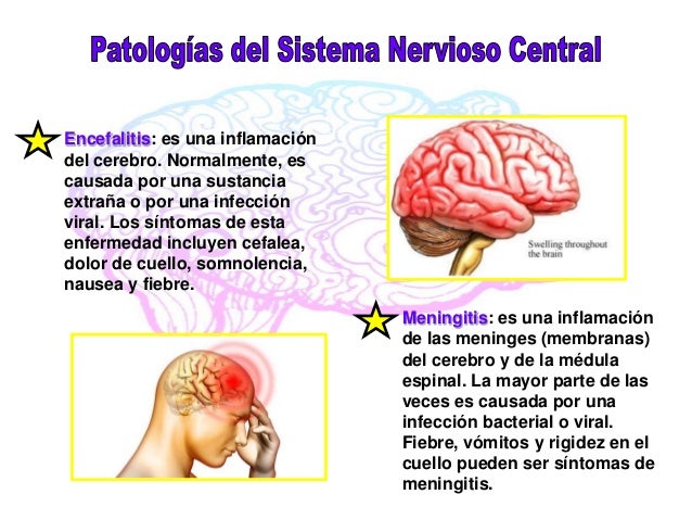 enfermedades del cerebro y del sistema nervioso enfermedades del cerebro y del sistema nervioso