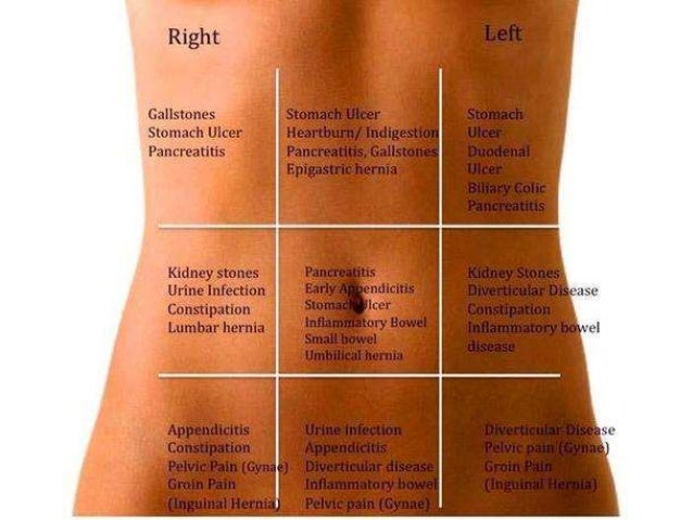 Acute Pancreatitis