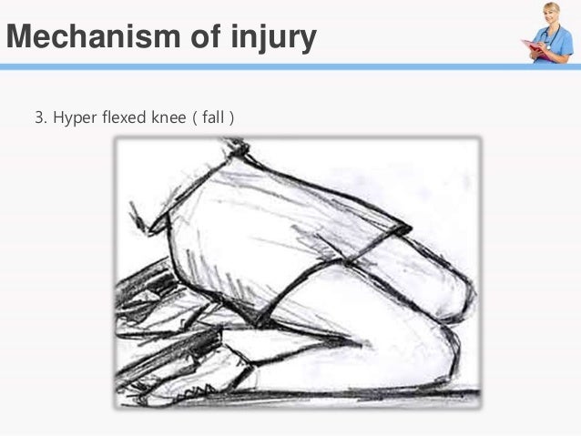first acl reconstruction surgical operation