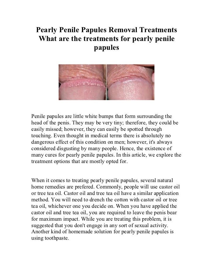Penile Papules Natural Treatment Penile Papules Natural Treatment