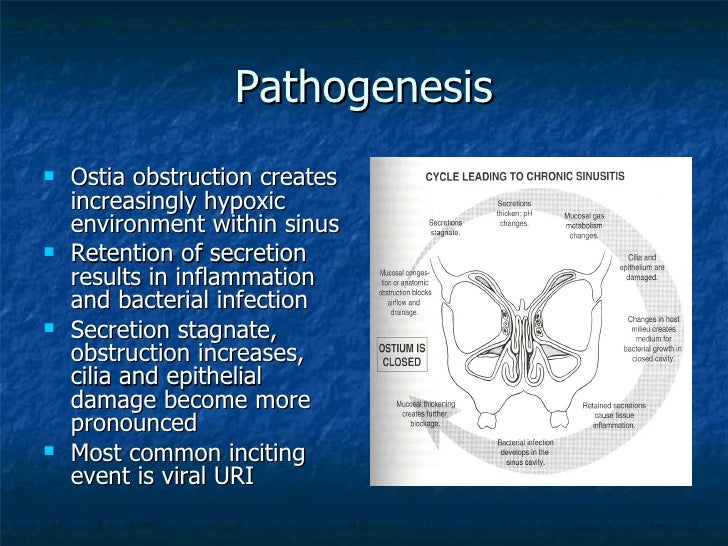 Pediatric Sinusitis