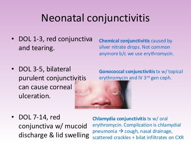 chlamydia vs gonorrhea symptoms chlamydia vs gonorrhea symptoms