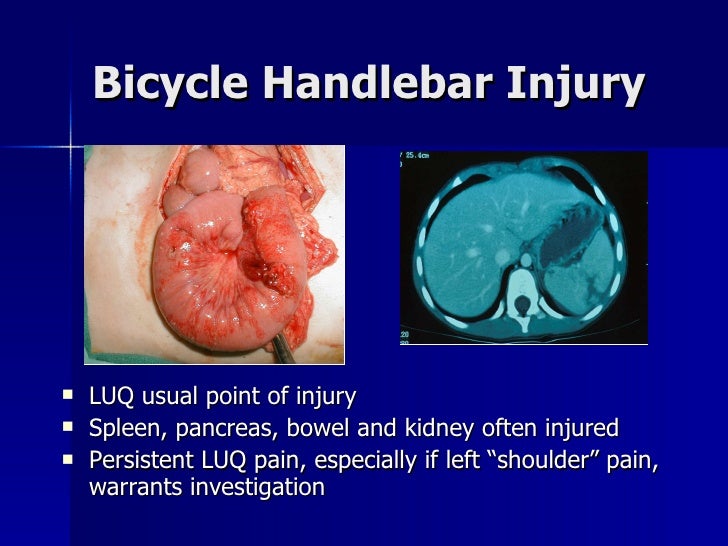 Pediatric Trauma Update For Trauma Call Surgeons