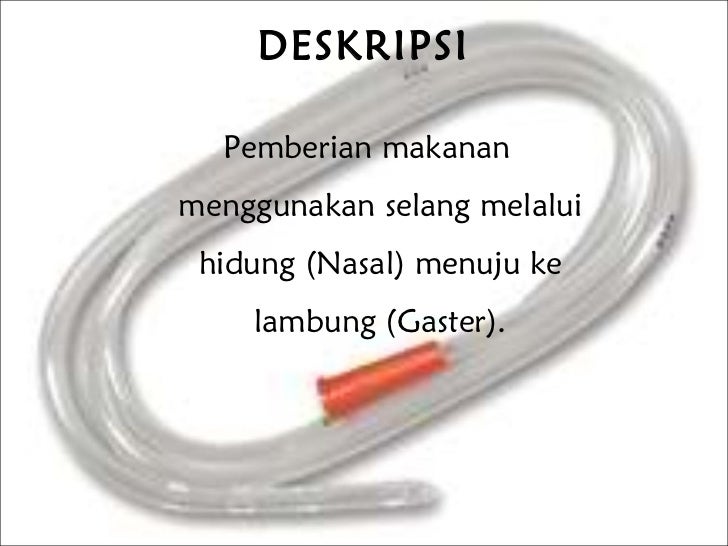 pemberian makanan melalui pipa lambung pemberian makanan melalui pipa lambung