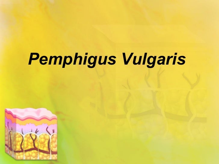 DermIS - Pemphigus Vulgaris (information on the diagnosis)