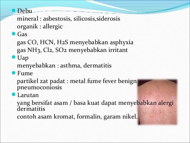 Penyakit akibat kerja dan hubungan kerja