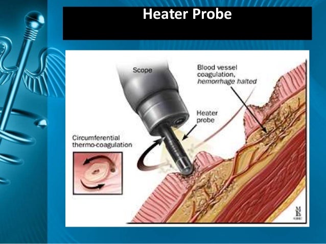 Peptic Ulcer Disease By Dr Sookun Rajeev Kumar M D Peptic Ulcer Disease By Dr Sookun Rajeev Kumar M D