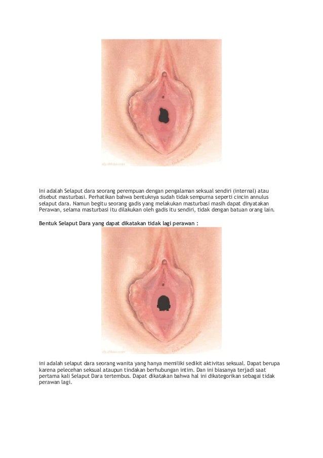 Gambar Vagina Virgin 23