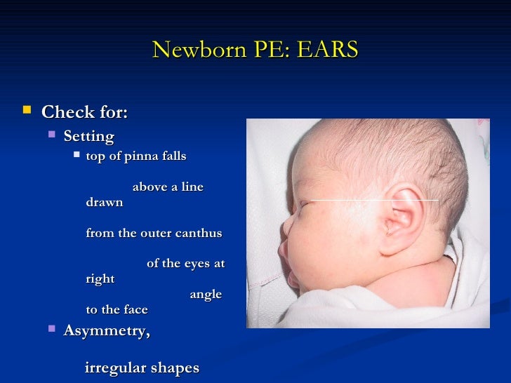 Perinatal history, normal newborn