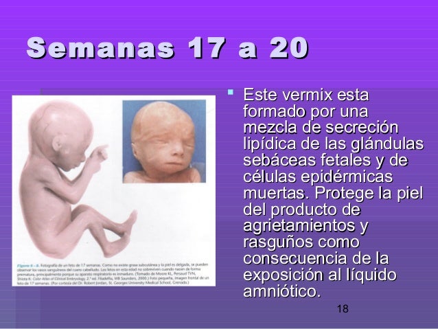 Fotos bebes 24 semanas gestacion 81 Fotos bebes 24 semanas gestacion 80