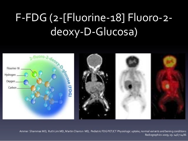 PET CT en Pediatría