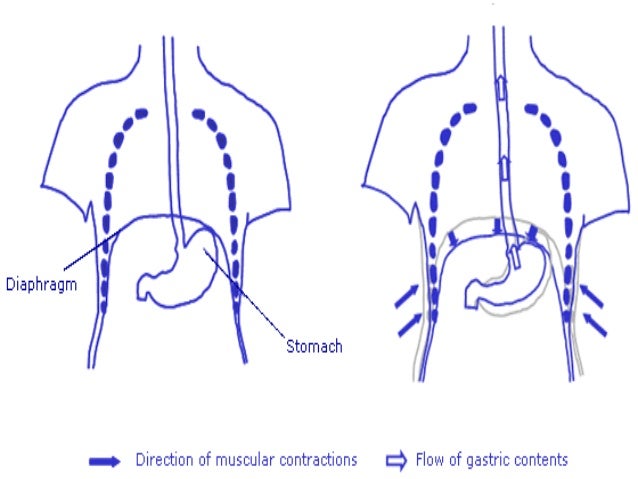 The function of pyloric sphincter is to prevent the backflow of food to