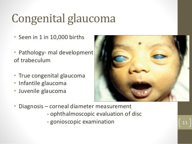 pharmacotherapy-of-glaucoma-11-638.jpg