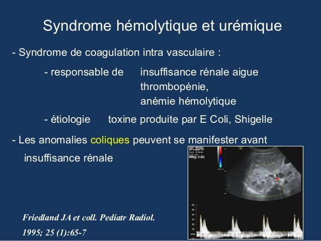Lymphome Quel Traitement