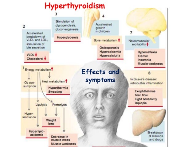 hypothyroidism essay hypothyroidism essay