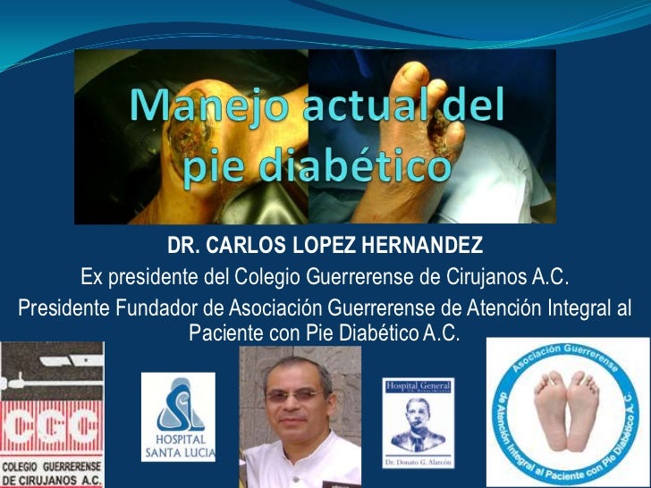 Tratamiento actual del pie diabetico Tratamiento actual del pie diabetico