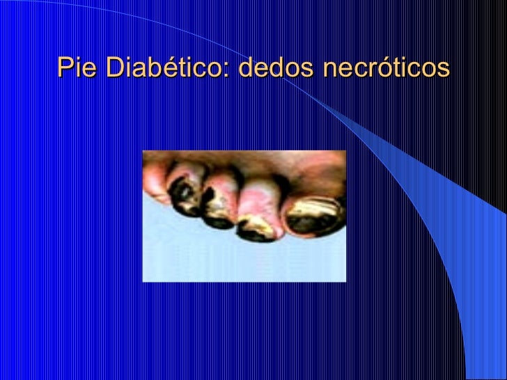 Pie Diabetico
