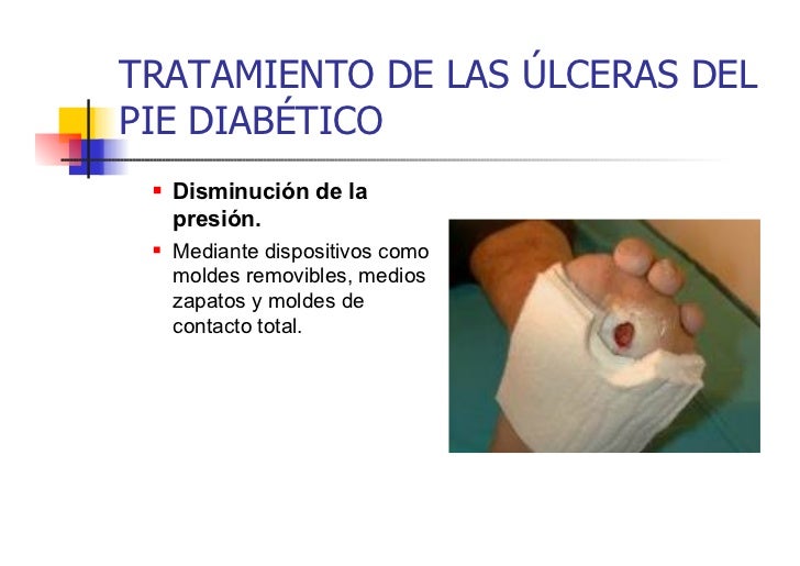 Pie diabetico