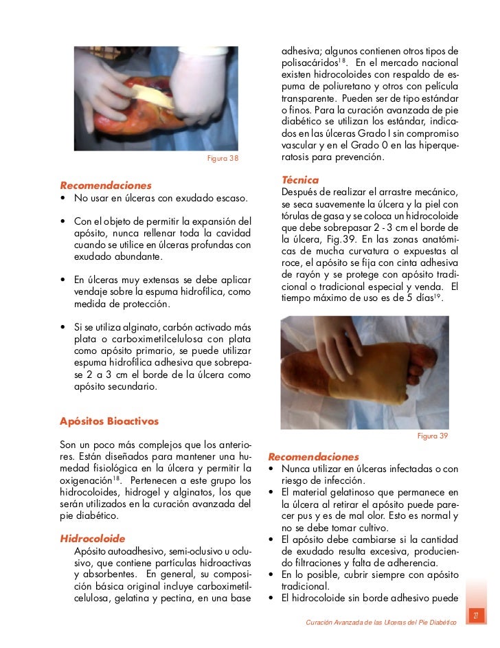Manual tratamiento : Pie diabetico Manual tratamiento : Pie diabetico