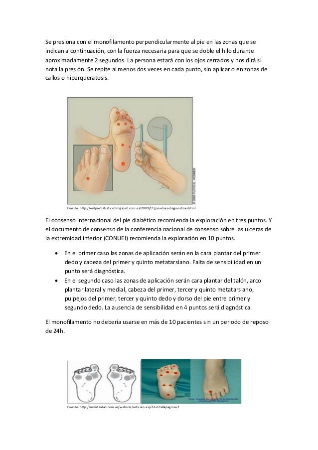 (20130219) REVISION DEL PIE DIABETICO (DOC)