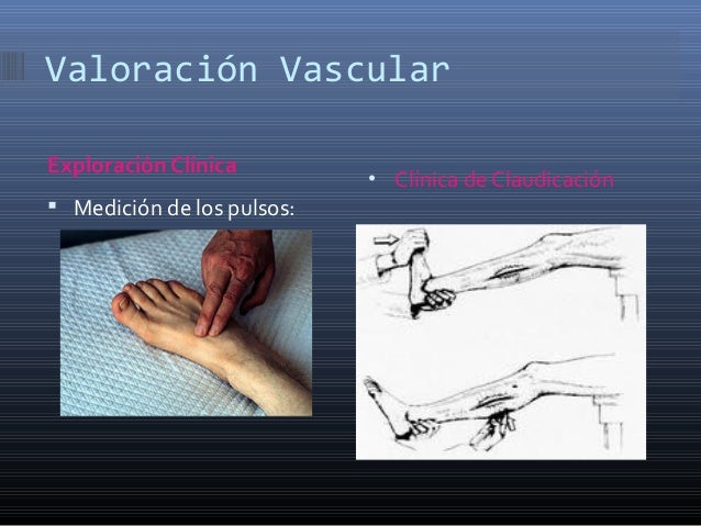 Pie Diabetico en Honduras Dr: Victor Raudales Pie Diabetico en Honduras Dr: Victor Raudales