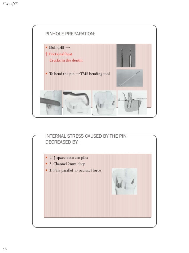Pin retained amalgam restorations
