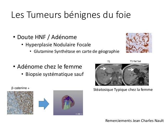 Le cancer autrefois traitement ciblé cancer