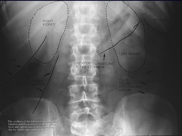 radiology.Plain abd.(dr.kawa)