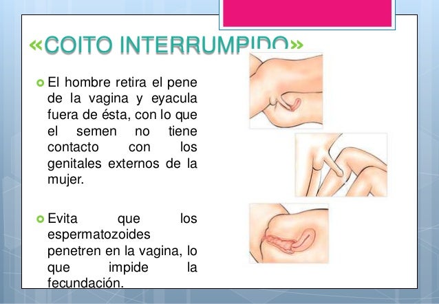 La crema de la irritación de la cabeza del miembro