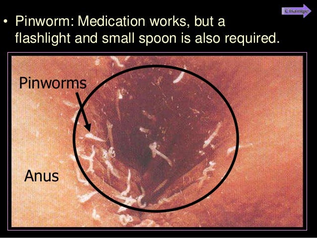 hpv virus gyogyithato cancer malign de colon