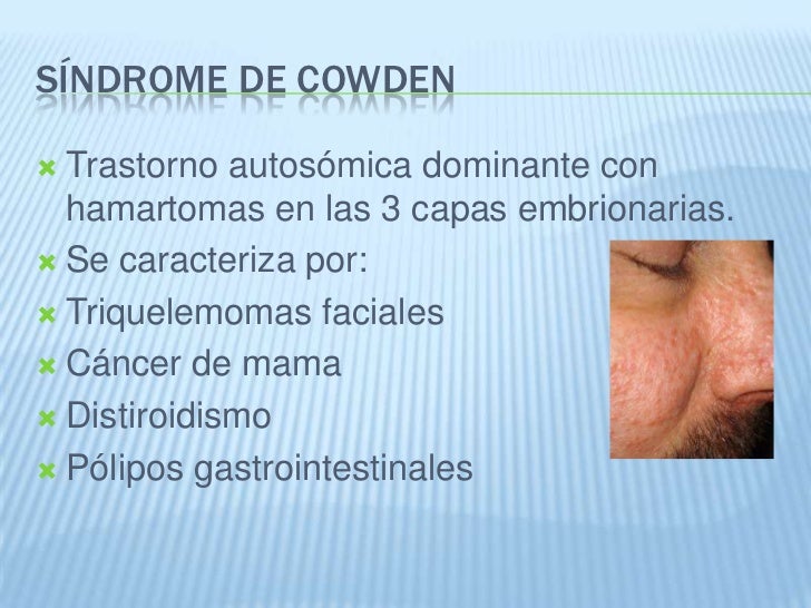 Sobre la cabeza de la corteza cae el cabello