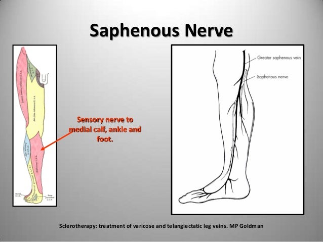 The Important Nerves During Venous Ablation