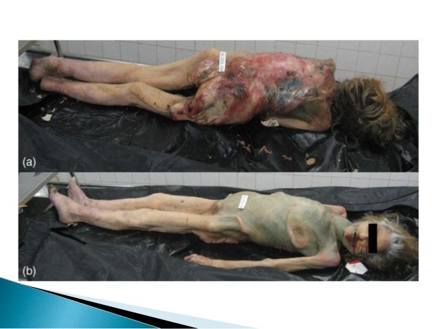 Human Decomposition Rate At Room Temperature Human Decomposition Rate At Room Temperature