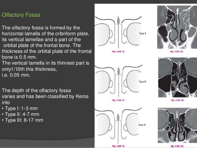 infected sinuses chronic nasal polyps chest ache