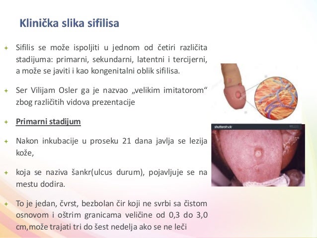 Polno Prenosive Bolesti Std polno-prenosive-bolesti-std