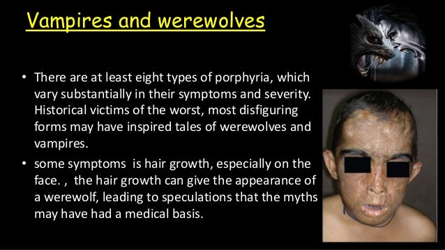 Vampire research paper picture