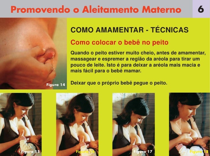 Em implantes de peito de Israel