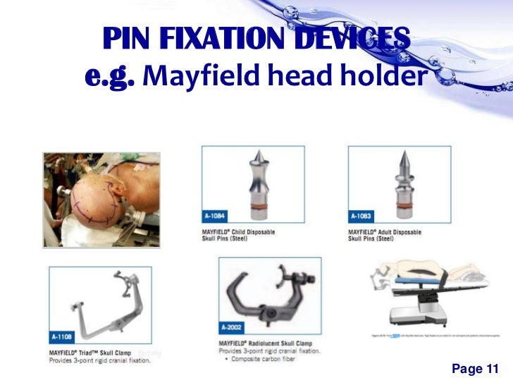 Positioning in neurosurgeries