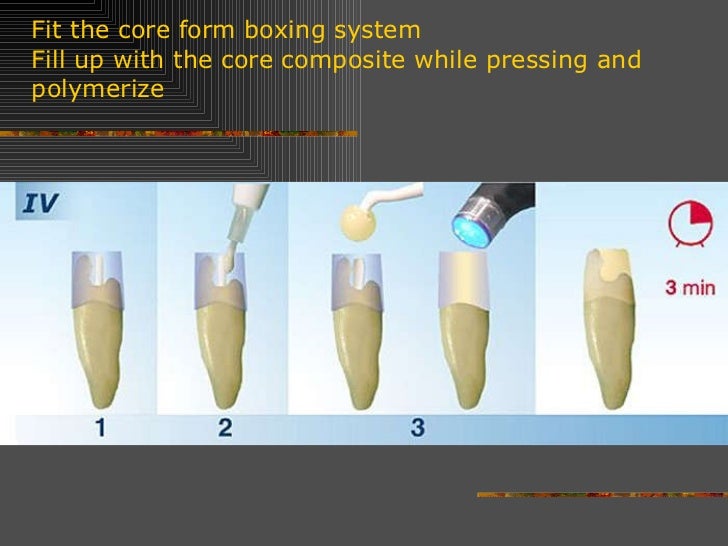 Post and core