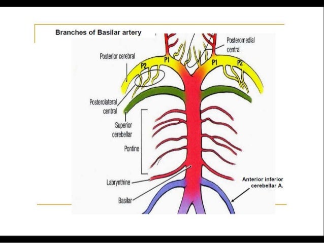 Posterior circulation stroke Syndromes