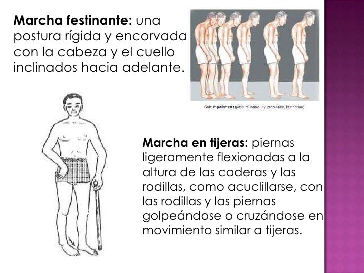 Postura y marcha
