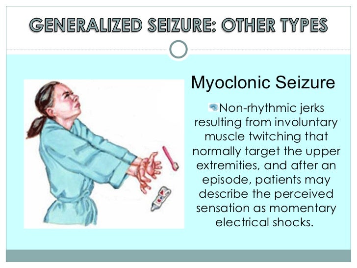 absense seizures in adults absense seizures in adults