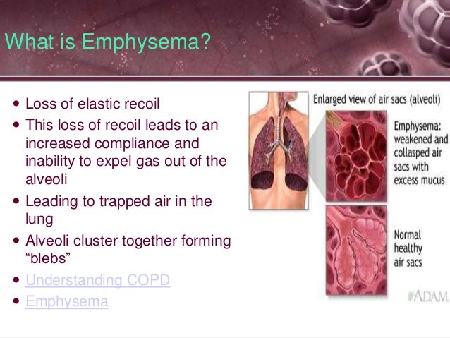 The Grape Like Clusters Of Air Sacs Within The Lungs