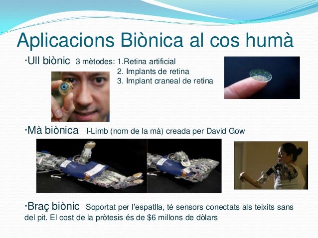 Aplicacions Biònica al cos humà·Ull biònic    3 mètodes: 1.Retina artificial                          2. Implants de retin...