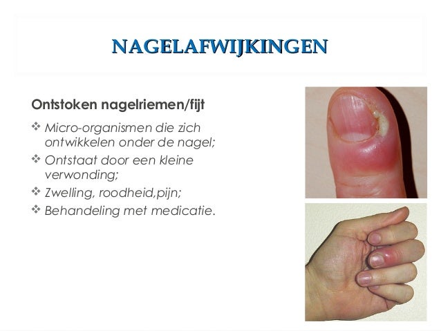 scheurende nagels oorzaak
