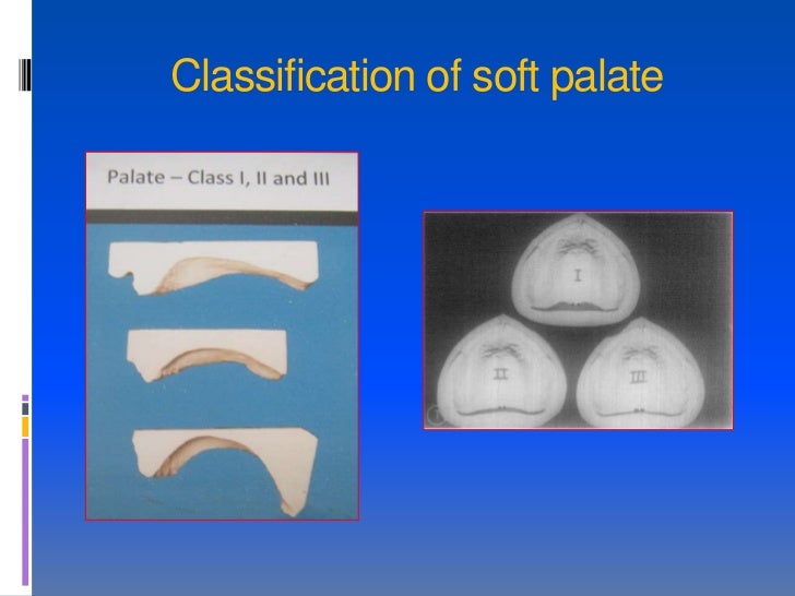 posterior palatal seal