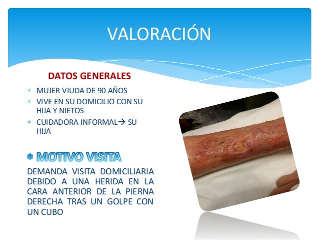 Ppt caso envejecimiento final Ppt caso envejecimiento final