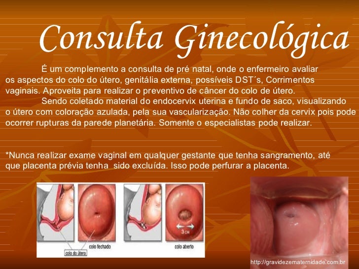 Feto em situacao longitudinal apresentacao cefalica com dorso a direita