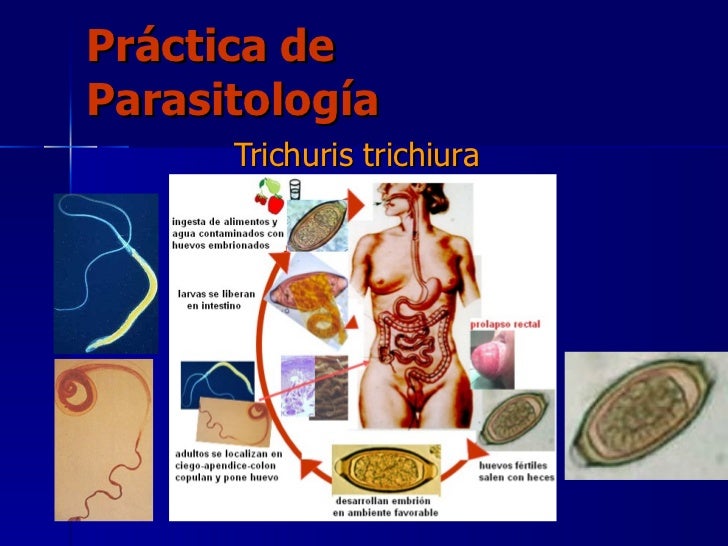 Trichuris trichiura