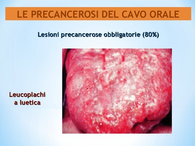 Chi come combattuto contro dipendenza alcolica